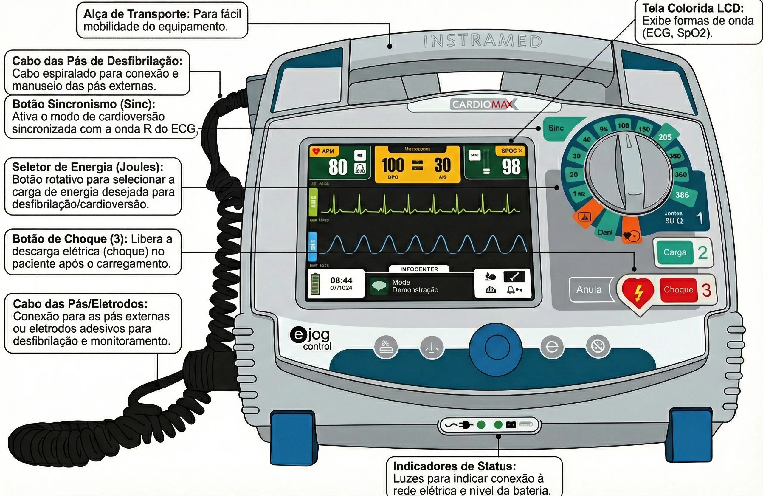 Cardioversor