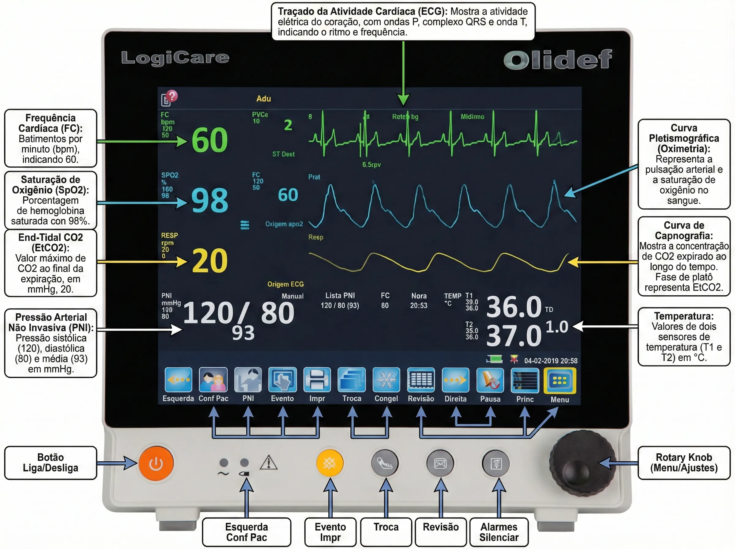 Monitor multiparametros