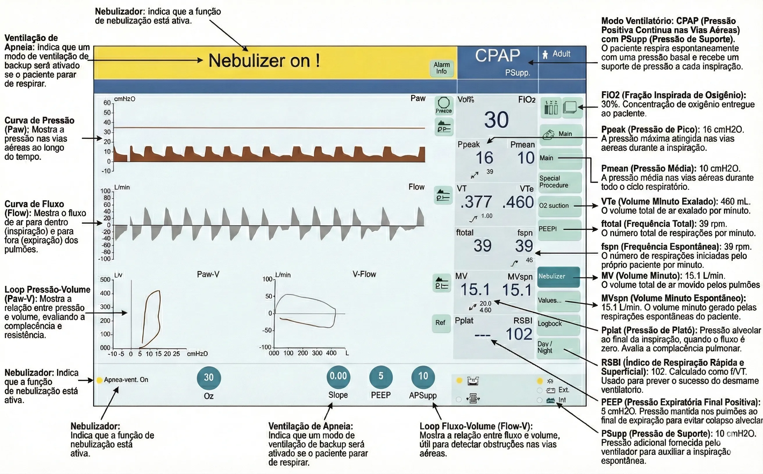 Display2 Ventilador Mecanico